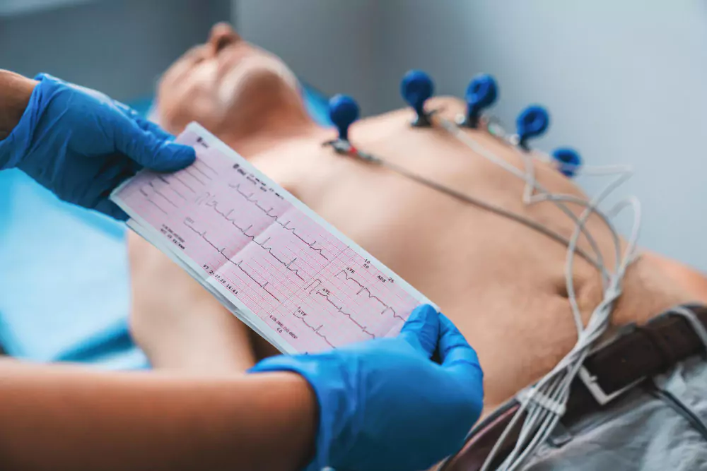 ECG (Electrocardiogram)